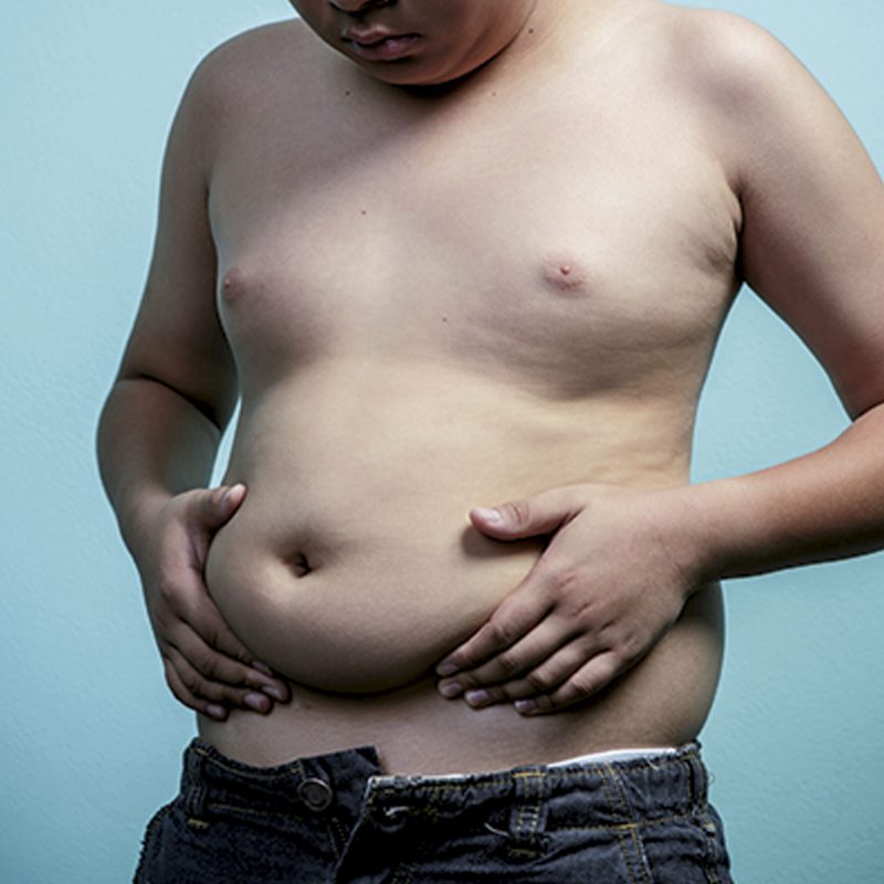 L’obésité, un problème majeur chez les mineurs!